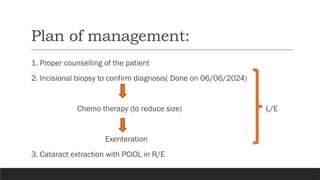 Plan of management:
1. Proper counselling of the patient
2. Incisional biopsy to confirm diagnosis( Done on 06/06/2024)
Chemo therapy (to reduce size) L/E
Exenteration
3. Cataract extraction with PCIOL in R/E
 