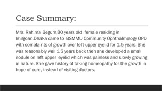 Case Summary:
Mrs. Rahima Begum,80 years old female residing in
khilgoan,Dhaka came to BSMMU Community Ophthalmology OPD
with complaints of growth over left upper eyelid for 1.5 years. She
was reasonably well 1.5 years back then she developed a small
nodule on left upper eyelid which was painless and slowly growing
in nature. She gave history of taking homeopathy for the growth in
hope of cure, instead of visiting doctors.
 