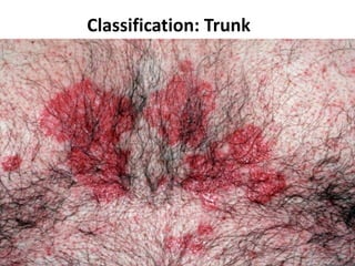 Classification: Trunk

 