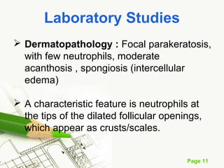 Page 11
Laboratory Studies
 Dermatopathology : Focal parakeratosis,
with few neutrophils, moderate
acanthosis , spongiosis (intercellular
edema)
 A characteristic feature is neutrophils at
the tips of the dilated follicular openings,
which appear as crusts/scales.
 