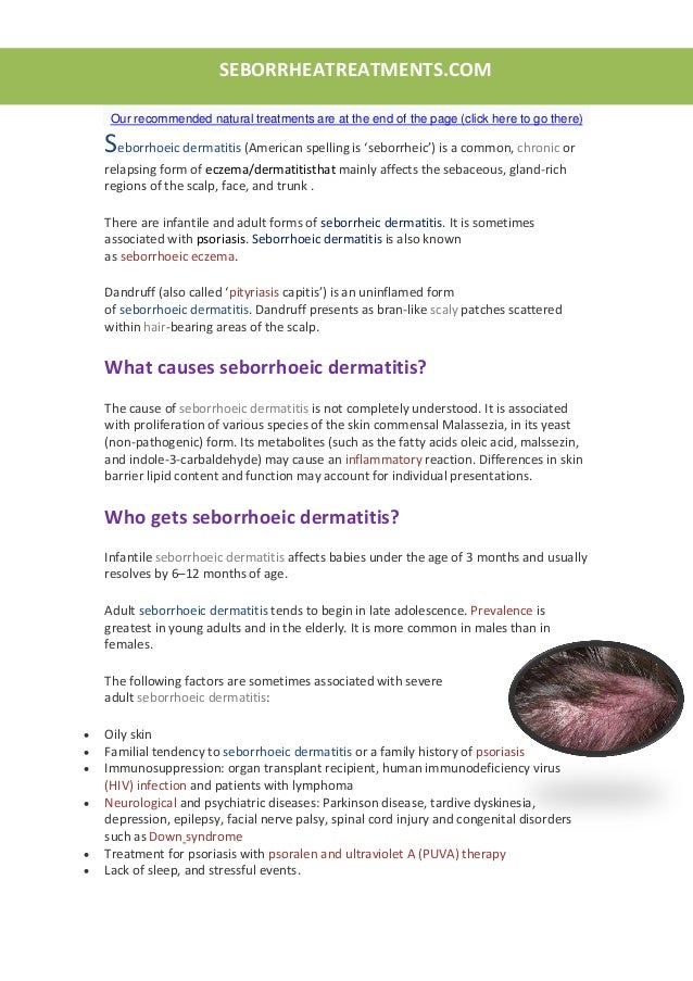 best treatment for dermatitis on scalp