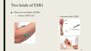 Sec 4 emg | PDF