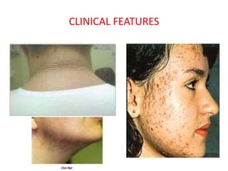CLINICAL FEATURES
 