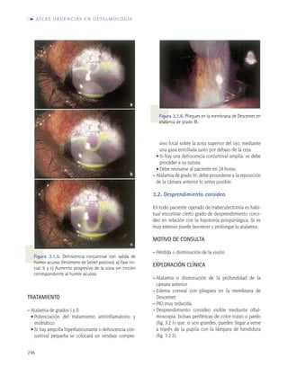 Sección 6. glaucoma e hipertensión ocular | PDF