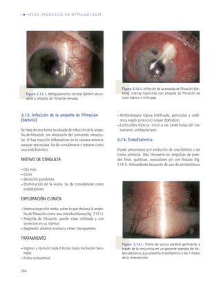 Sección 6. glaucoma e hipertensión ocular | PDF
