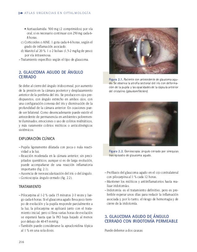 Más en hipertensión arterial complicaciones