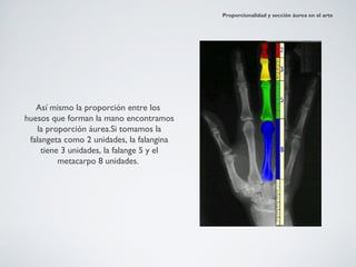 Proporcionalidad y sección áurea en el arte




   Así mismo la proporción entre los
huesos que forman la mano encontramos
   la proporción áurea.Si tomamos la
 falangeta como 2 unidades, la falangina
     tiene 3 unidades, la falange 5 y el
          metacarpo 8 unidades.
 
