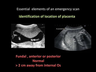 Essential elements of an emergency scan
 