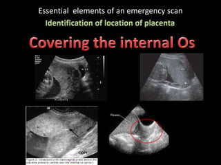 Essential elements of an emergency scan
 