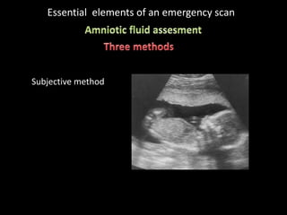 Essential elements of an emergency scan
Subjective method
 