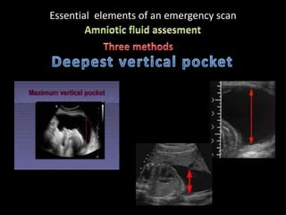 Essential elements of an emergency scan
 