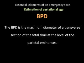 Essential elements of an emergency scan
The BPD is the maximum diameter of a transverse
section of the fetal skull at the level of the
.parietal eminences
 