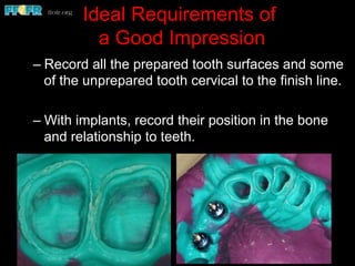 Ideal Requirements of
a Good Impression
– Record all the prepared tooth surfaces and some
of the unprepared tooth cervical to the finish line.
– With implants, record their position in the bone
and relationship to teeth.
 