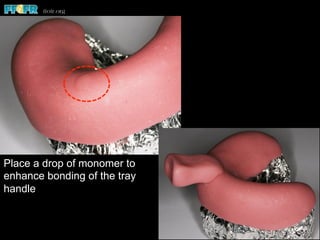 Place a drop of monomer to
enhance bonding of the tray
handle
 