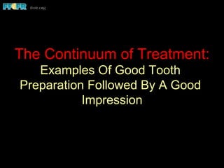 The Continuum of Treatment:
Examples Of Good Tooth
Preparation Followed By A Good
Impression
 