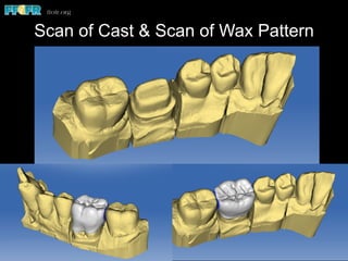Scan of Cast & Scan of Wax Pattern
 