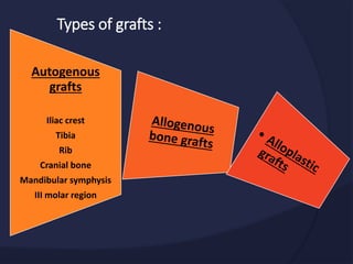 Types of grafts :
Autogenous
grafts
Iliac crest
Tibia
Rib
Cranial bone
Mandibular symphysis
III molar region
 