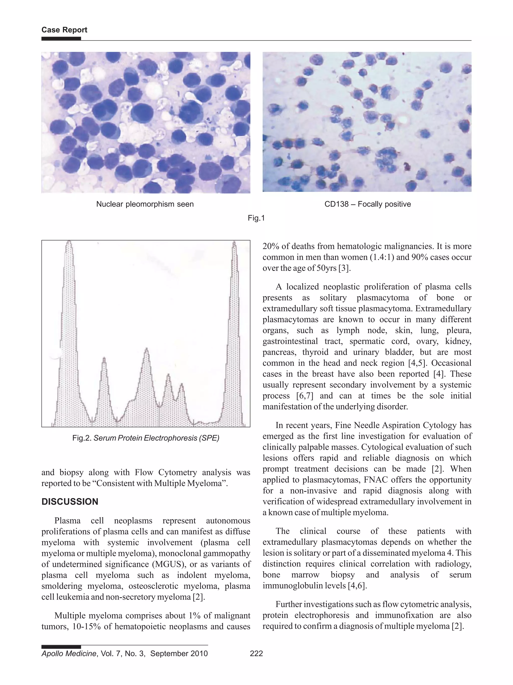 Secondary Extramedullary Plasmacytoma Diagnosed by Fine Needle ...