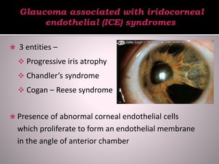  3 entities –
 Progressive iris atrophy
 Chandler’s syndrome
 Cogan – Reese syndrome
 Presence of abnormal corneal endothelial cells
which proliferate to form an endothelial membrane
in the angle of anterior chamber
 