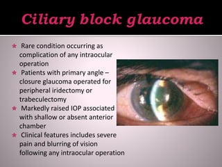  Rare condition occurring as
complication of any intraocular
operation
 Patients with primary angle –
closure glaucoma operated for
peripheral iridectomy or
trabeculectomy
 Markedly raised IOP associated
with shallow or absent anterior
chamber
 Clinical features includes severe
pain and blurring of vision
following any intraocular operation
 