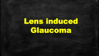 Lens induced
Glaucoma
 