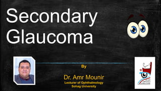 Secondary
Glaucoma
Subtitle
By
Dr. Amr Mounir
Lecturer of Ophthalmology
Sohag University
 