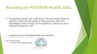 Recording the POSTERIOR PALATAL SEAL;
 The posterior palatal seal is defined as “The soft tissues along the
junction of hard and soft palate on which pressure within the
physiological limits of tissue can be applied by a denture to aid in
retenture of denture”.GPT
 CLASSIFICATION OF POSTERIOR PALATAL SEAL AREA(PPS)
 