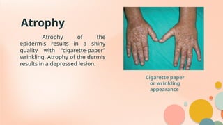 does newport still make menthol cigarettes Newport Menthol Gold King Cigarettes (#165311)