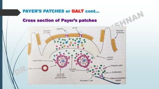 PAYER’S PATCHES or GALT cont…
Cross section of Payer’s patches
 