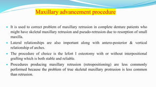 Maxillary advancement procedure
 It is used to correct problem of maxillary retrusion in complete denture patients who
might have skeletal maxillary retrusion and pseudo-retrusion due to resorption of small
maxilla.
 Lateral relationships are also important along with antero-posterior & vertical
relationship of arches.
 The procedure of choice is the lefort I osteotomy with or without interpositional
grafting which is both stable and reliable.
 Procedures producing maxillary retrusion (retropositioning) are less commonly
performed because the problem of true skeletal maxillary protrusion is less common
than retrusion.
 
