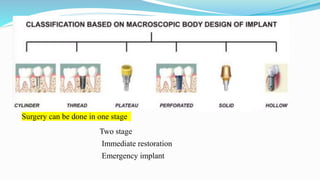  Based on macroscopic body design of implant :
Cylinder
Thread
Perforated
Plateau
Solid
Hollow
Surgery can be done in one stage
Two stage
Immediate restoration
Emergency implant
 
