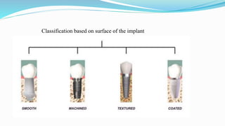 Classification based on surface of the implant
Smooth
Machined
Textured
Coated
 