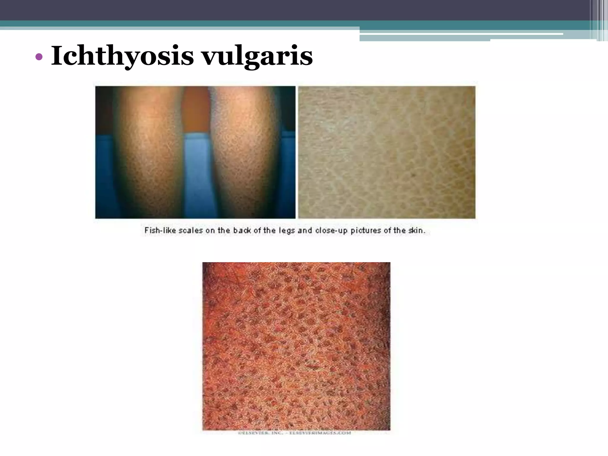 Is That An Ulcer?  Identifying Secondary Skin Lesions - 8dtpkq4