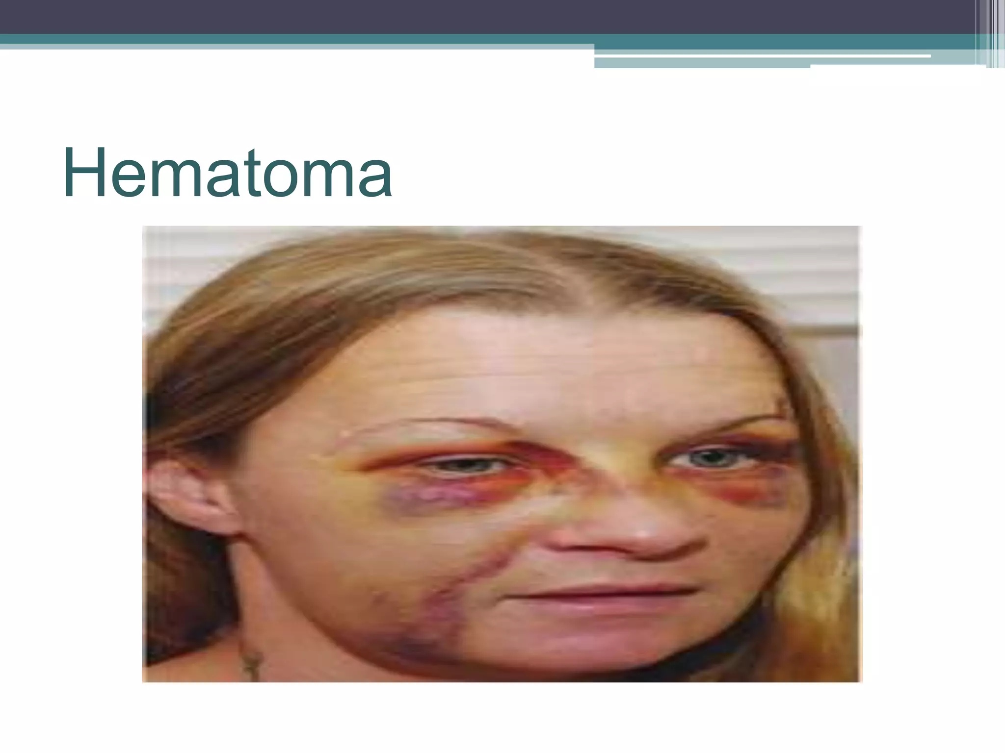 Is That An Ulcer?  Identifying Secondary Skin Lesions - ainnpps