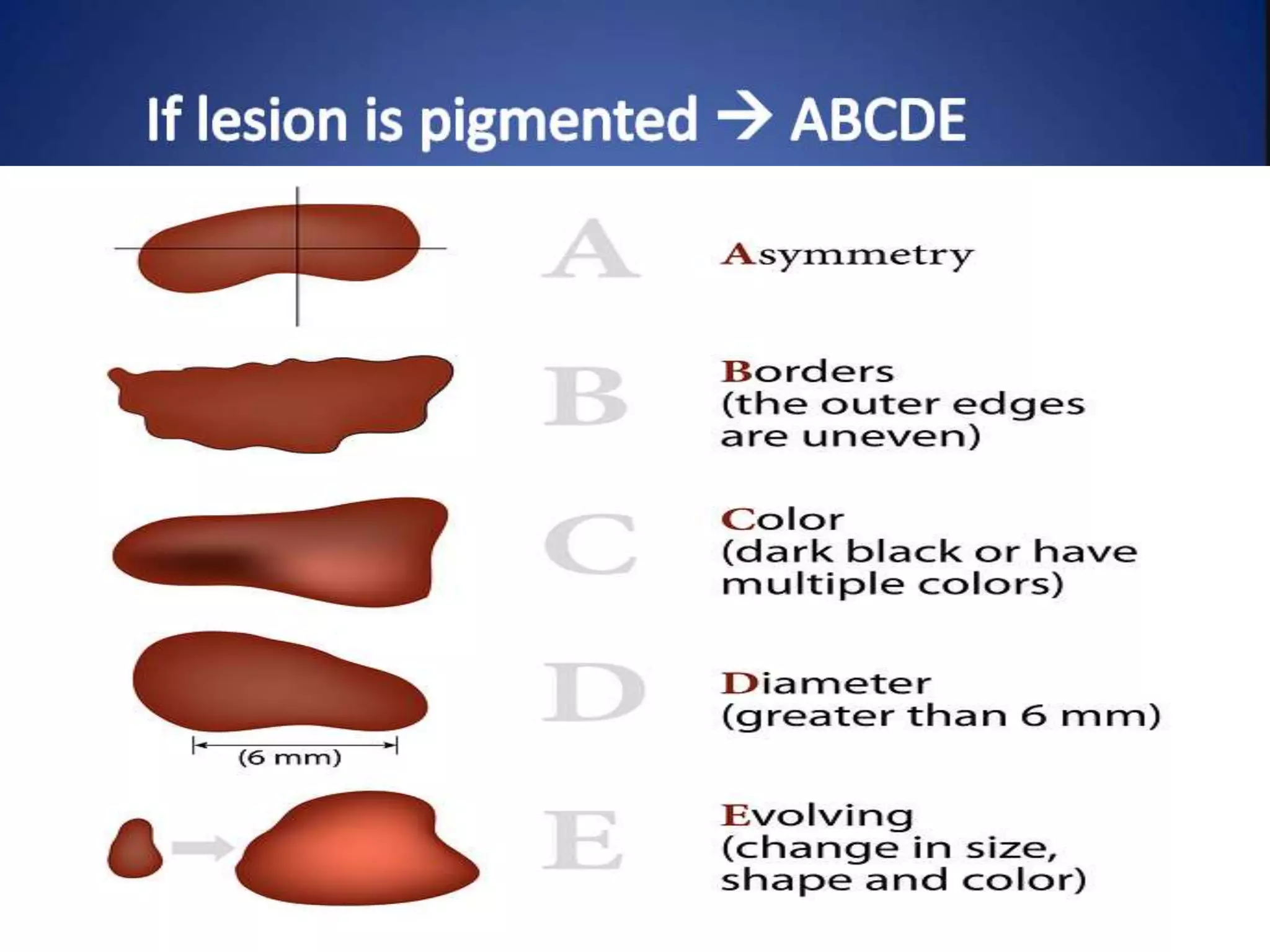 Is That An Ulcer?  Identifying Secondary Skin Lesions - xe4polz