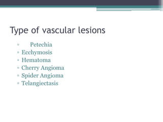 Type of vascular lesions
▫ Petechia
▫ Ecchymosis
▫ Hematoma
▫ Cherry Angioma
▫ Spider Angioma
▫ Telangiectasis
 
