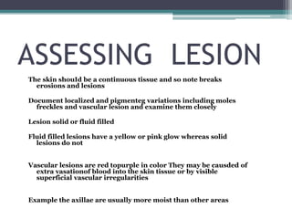 ASSESSING LESION
The skin shouId be a continuous tissue and so note breaks
erosions and lesions
Document localized and pigmenteg variations including moles
freckles and vascular lesion and examine them closely
Lesion solid or fluid filled
Fluid filled lesions have a yellow or pink glow whereas solid
lesions do not
Vascular lesions are red topurple in color They may be causded of
extra vasationof blood into the skin tissue or by visible
superficial vascular irregularities
Example the axillae are usually more moist than other areas
 