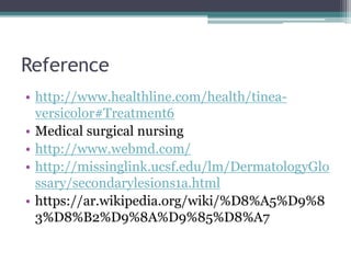 Reference
• http://www.healthline.com/health/tinea-
versicolor#Treatment6
• Medical surgical nursing
• http://www.webmd.com/
• http://missinglink.ucsf.edu/lm/DermatologyGlo
ssary/secondarylesions1a.html
• https://ar.wikipedia.org/wiki/%D8%A5%D9%8
3%D8%B2%D9%8A%D9%85%D8%A7
 
