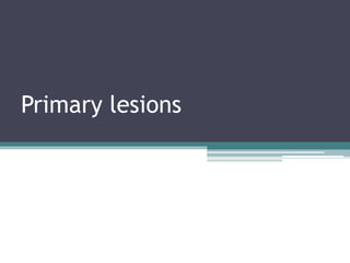 Primary lesions
 