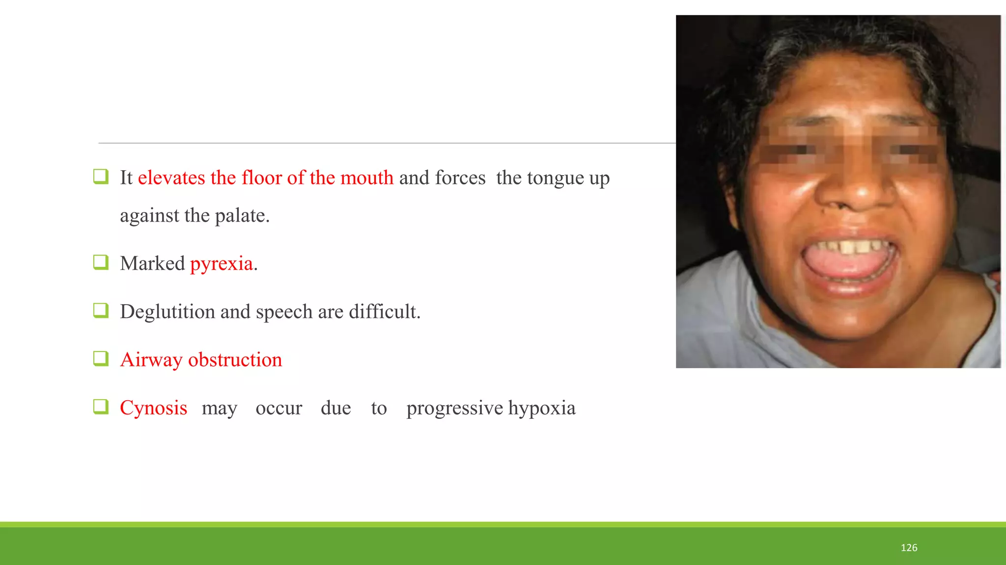  It elevates the floor of the mouth and forces the tongue up
against the palate.
 Marked pyrexia.
 Deglutition and speech are difficult.
 Airway obstruction
 Cynosis may occur due to progressive hypoxia
126
 