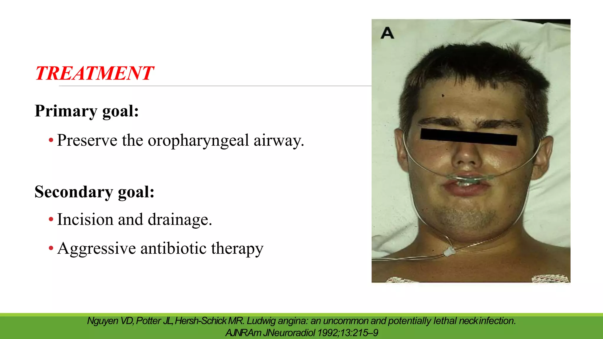 TREATMENT
Primary goal:
• Preserve the oropharyngeal airway.
Secondary goal:
• Incision and drainage.
• Aggressive antibiotic therapy
Nguyen VD,Potter JL,Hersh-SchickMR. Ludwig angina: an uncommon and potentially lethal neckinfection.
AJNRAmJNeuroradiol 1992;13:215–9
 