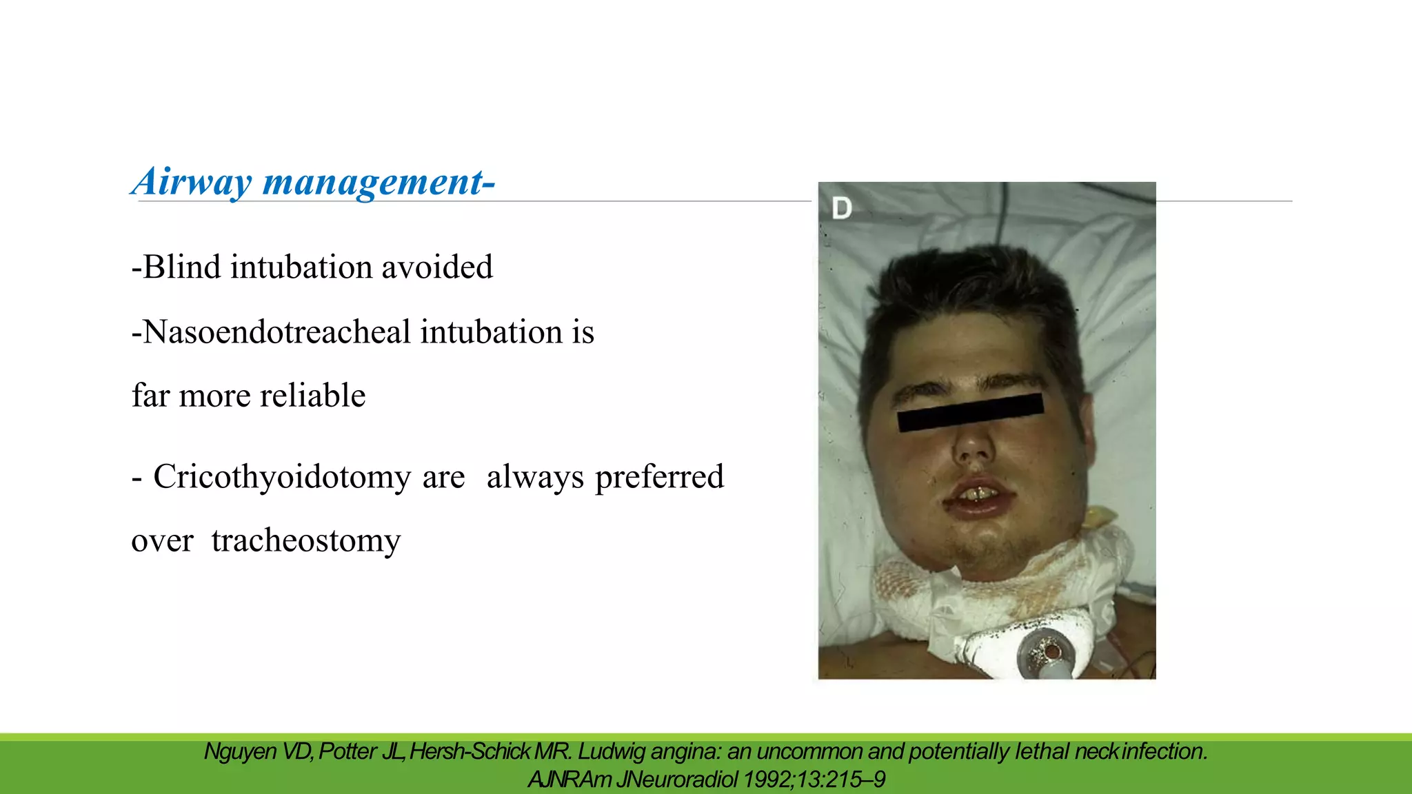 Airway management-
-Blind intubation avoided
-Nasoendotreacheal intubation is
far more reliable
- Cricothyoidotomy are always preferred
over tracheostomy
Nguyen VD,Potter JL,Hersh-SchickMR. Ludwig angina: an uncommon and potentially lethal neckinfection.
AJNRAmJNeuroradiol 1992;13:215–9
 