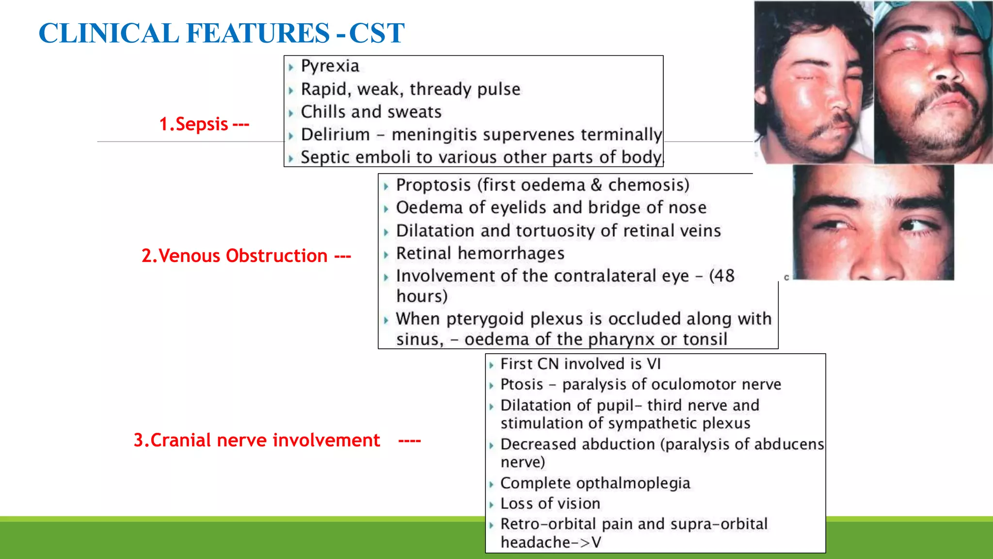 CLINICAL FEATURES -CST
1.Sepsis ---
2.Venous Obstruction ---
3.Cranial nerve involvement ----
 