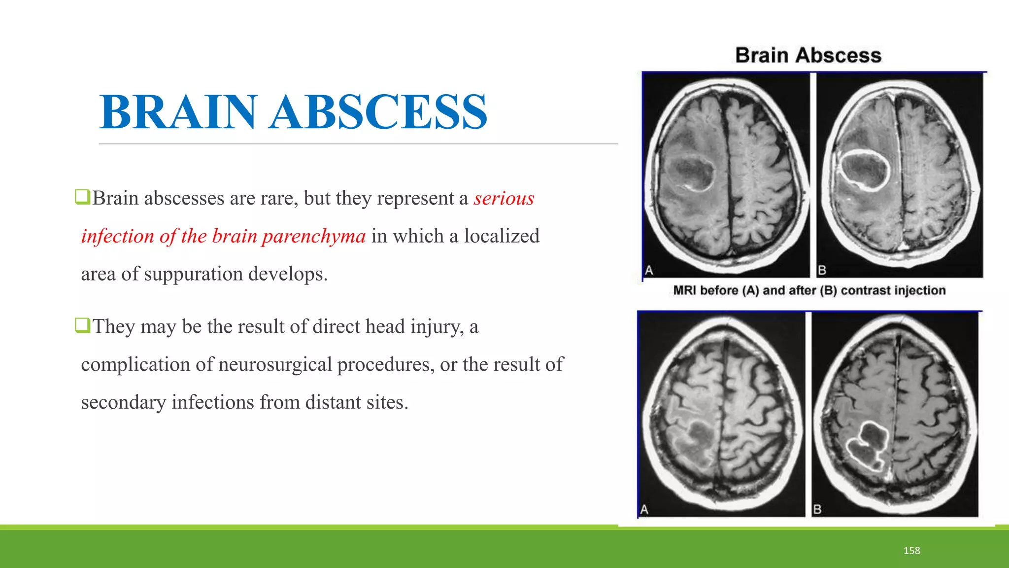 BRAIN ABSCESS
Brain abscesses are rare, but they represent a serious
infection of the brain parenchyma in which a localized
area of suppuration develops.
They may be the result of direct head injury, a
complication of neurosurgical procedures, or the result of
secondary infections from distant sites.
158
 