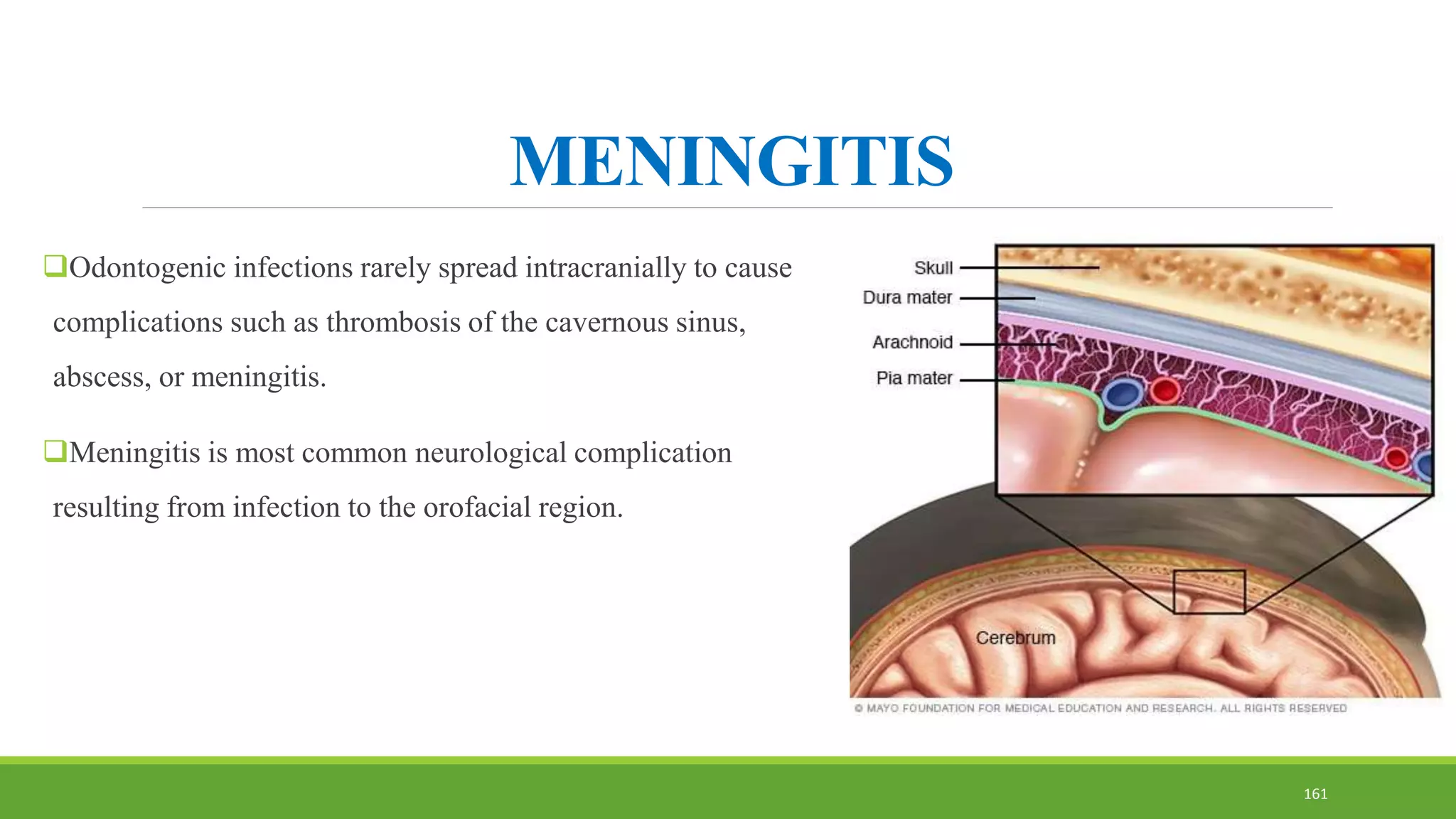 MENINGITIS
Odontogenic infections rarely spread intracranially to cause
complications such as thrombosis of the cavernous sinus,
abscess, or meningitis.
Meningitis is most common neurological complication
resulting from infection to the orofacial region.
161
 