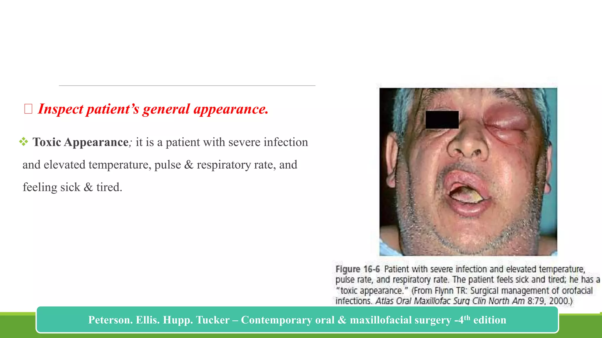 Inspect patient’s general appearance.
 Toxic Appearance; it is a patient with severe infection
and elevated temperature, pulse & respiratory rate, and
feeling sick & tired.
182
Peterson. Ellis. Hupp. Tucker – Contemporary oral & maxillofacial surgery -4th edition
 