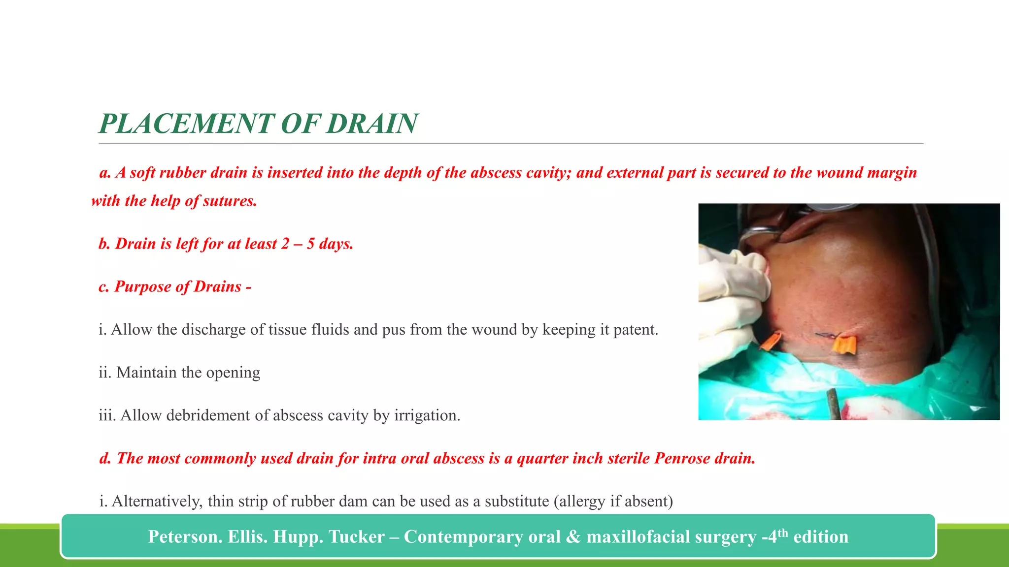 PLACEMENT OF DRAIN
a. A soft rubber drain is inserted into the depth of the abscess cavity; and external part is secured to the wound margin
with the help of sutures.
b. Drain is left for at least 2 – 5 days.
c. Purpose of Drains -
i. Allow the discharge of tissue fluids and pus from the wound by keeping it patent.
ii. Maintain the opening
iii. Allow debridement of abscess cavity by irrigation.
d. The most commonly used drain for intra oral abscess is a quarter inch sterile Penrose drain.
i. Alternatively, thin strip of rubber dam can be used as a substitute (allergy if absent)
196
Peterson. Ellis. Hupp. Tucker – Contemporary oral & maxillofacial surgery -4th edition
 