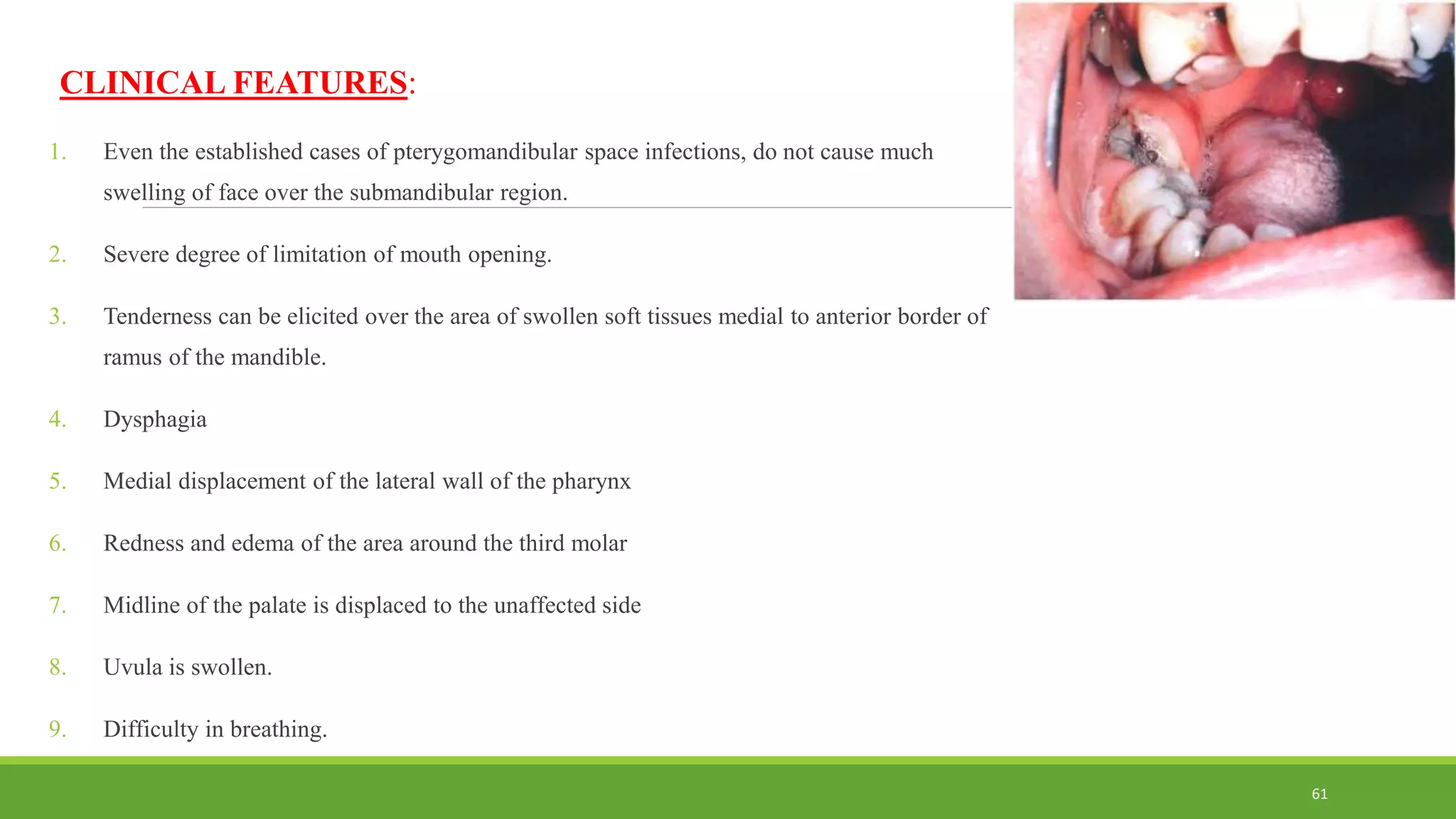 CLINICAL FEATURES:
1. Even the established cases of pterygomandibular space infections, do not cause much
swelling of face over the submandibular region.
2. Severe degree of limitation of mouth opening.
3. Tenderness can be elicited over the area of swollen soft tissues medial to anterior border of
ramus of the mandible.
4. Dysphagia
5. Medial displacement of the lateral wall of the pharynx
6. Redness and edema of the area around the third molar
7. Midline of the palate is displaced to the unaffected side
8. Uvula is swollen.
9. Difficulty in breathing.
61
 
