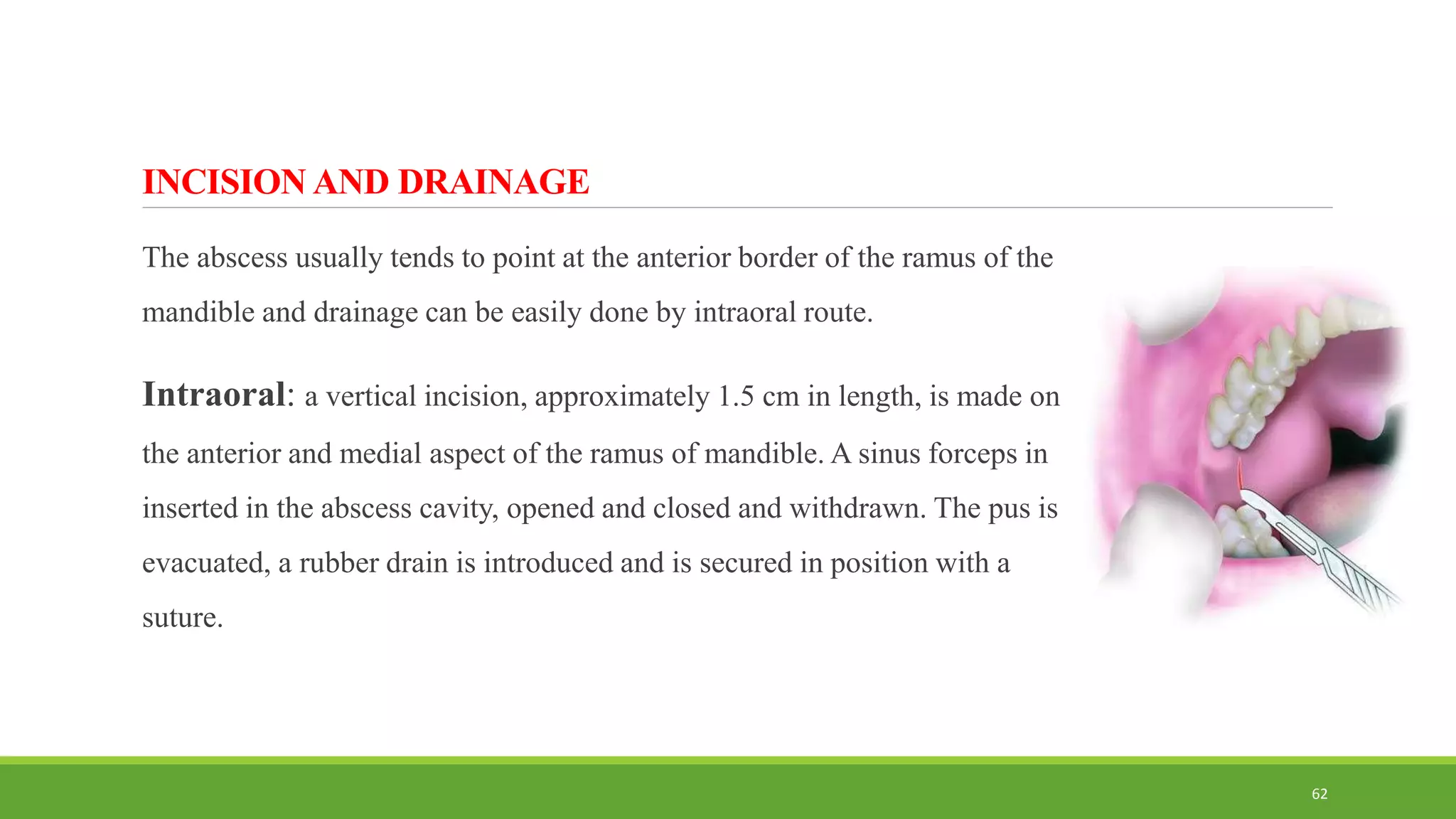 INCISION AND DRAINAGE
The abscess usually tends to point at the anterior border of the ramus of the
mandible and drainage can be easily done by intraoral route.
Intraoral: a vertical incision, approximately 1.5 cm in length, is made on
the anterior and medial aspect of the ramus of mandible. A sinus forceps in
inserted in the abscess cavity, opened and closed and withdrawn. The pus is
evacuated, a rubber drain is introduced and is secured in position with a
suture.
62
 