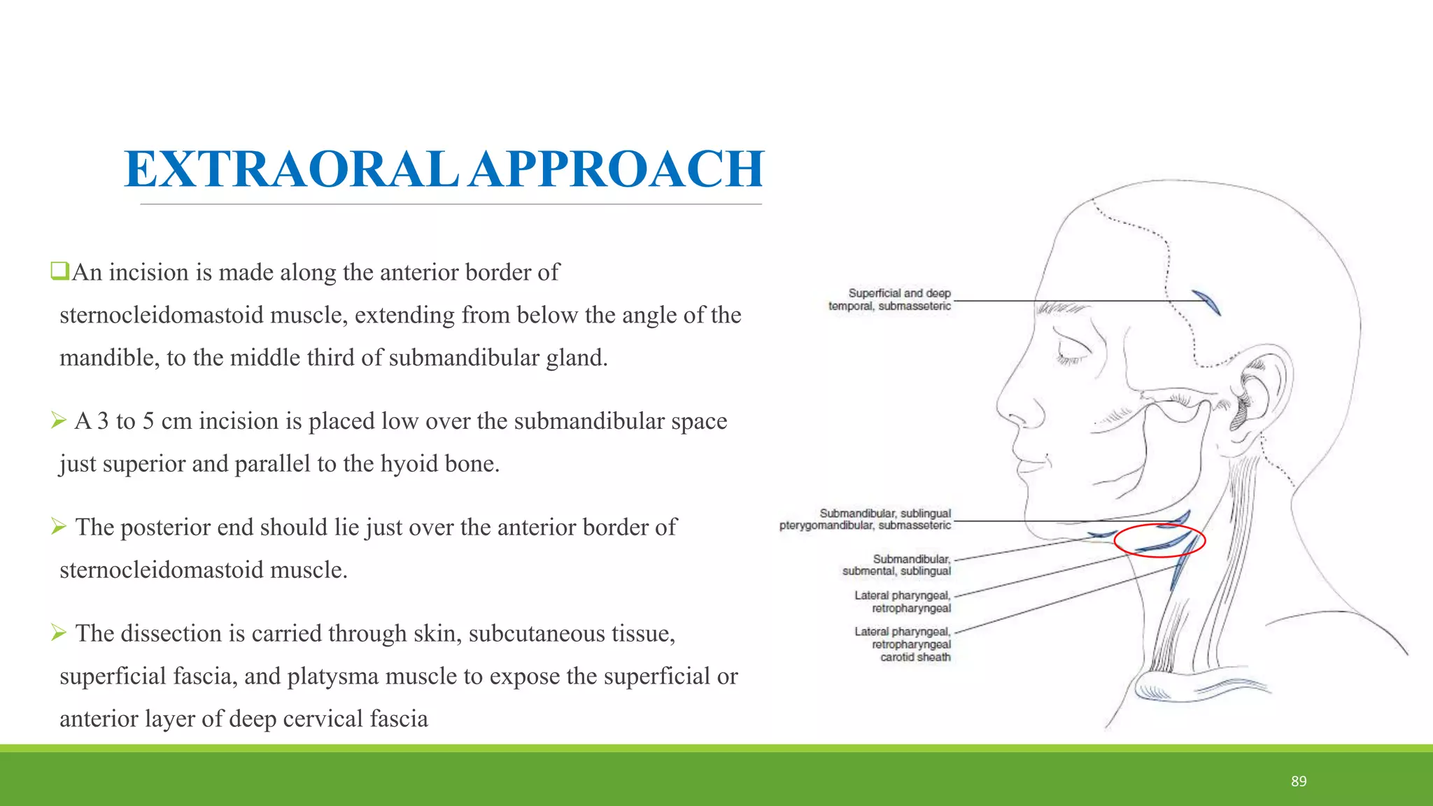 EXTRAORALAPPROACH -
An incision is made along the anterior border of
sternocleidomastoid muscle, extending from below the angle of the
mandible, to the middle third of submandibular gland.
 A 3 to 5 cm incision is placed low over the submandibular space
just superior and parallel to the hyoid bone.
 The posterior end should lie just over the anterior border of
sternocleidomastoid muscle.
 The dissection is carried through skin, subcutaneous tissue,
superficial fascia, and platysma muscle to expose the superficial or
anterior layer of deep cervical fascia
89
 